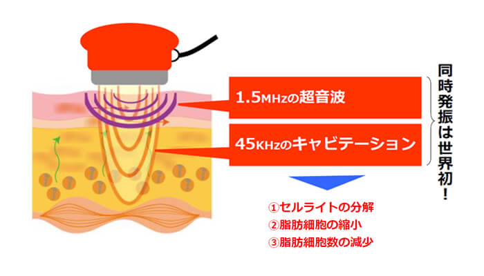 Cavi MAXだけの新技術デュアルキャビテーション