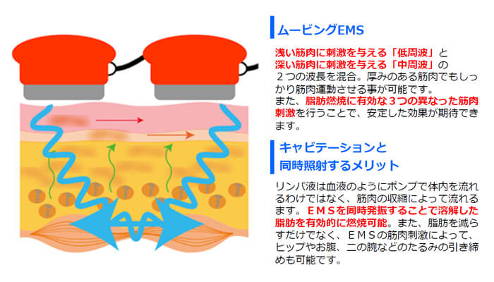 Cavi MAXだけの新技術ムービングEMS